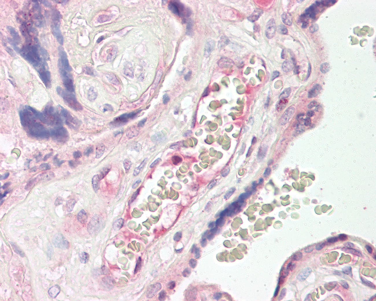 TEM7 Antibody (aa74-123)