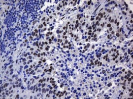 ZSCAN18 / ZNF447 Antibody (clone OTI4D10, Carrier-free)