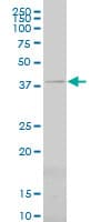 Monoclonal Mouse anti-Human PSMC6 Antibody (clone 2C4, IF, WB)