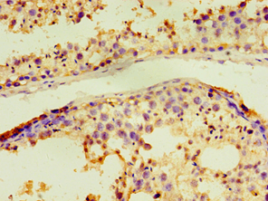 ACRV1/Intra-Acrosomal Protein Antibody (aa22-265)