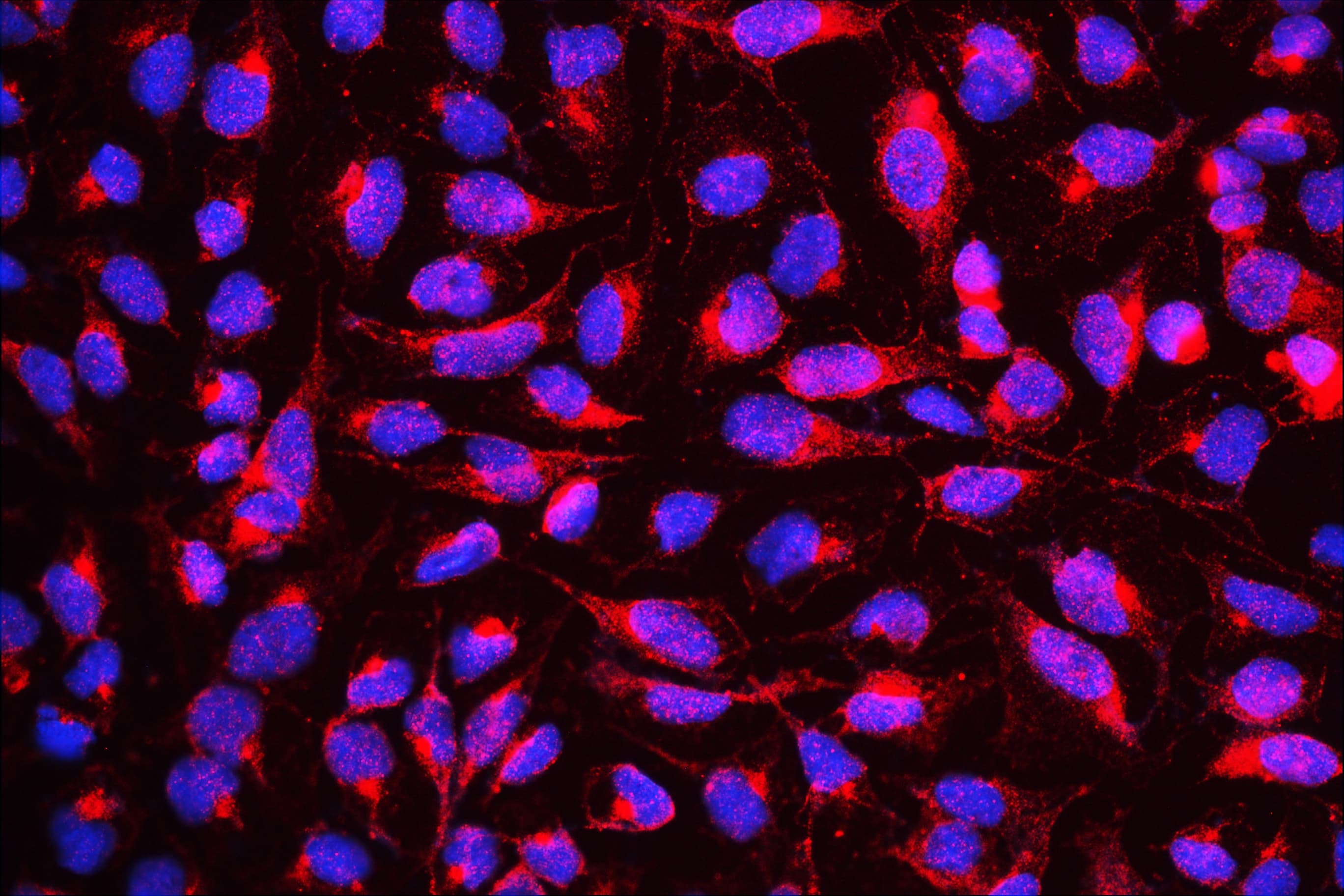 DYRK / DYRK1A Antibody