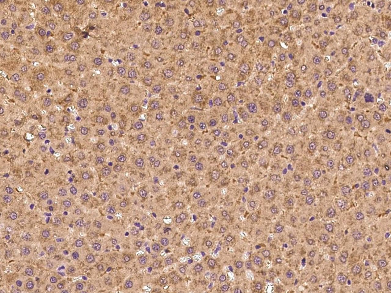 NRP1 / Neuropilin 1 Antibody