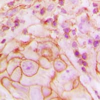 Polyclonal Rabbit anti-Human P2RY14 / GPR105 Antibody (Internal, IHC, WB)