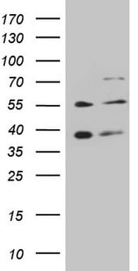 GRK4 Antibody (aa1-245, clone OTI9A3, Carrier-free)
