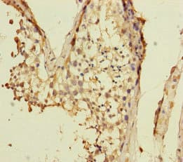 VPS33B Antibody