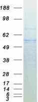 Human EED Protein (Recombinant Myc-DDK (Flag))