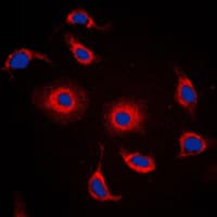 Polyclonal Rabbit anti-Human FXR2 Antibody (C-Terminus, IHC, IF, WB)