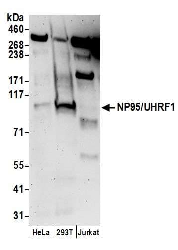 UHRF1 Antibody (aa275-325)