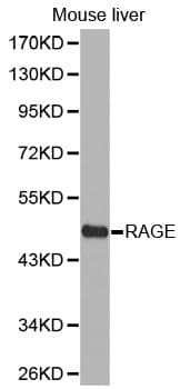 MOK / RAGE Antibody