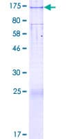 Human SLC39A10 / ZIP10 Protein (Recombinant GST)