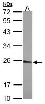 NAR / CPSF4 Antibody