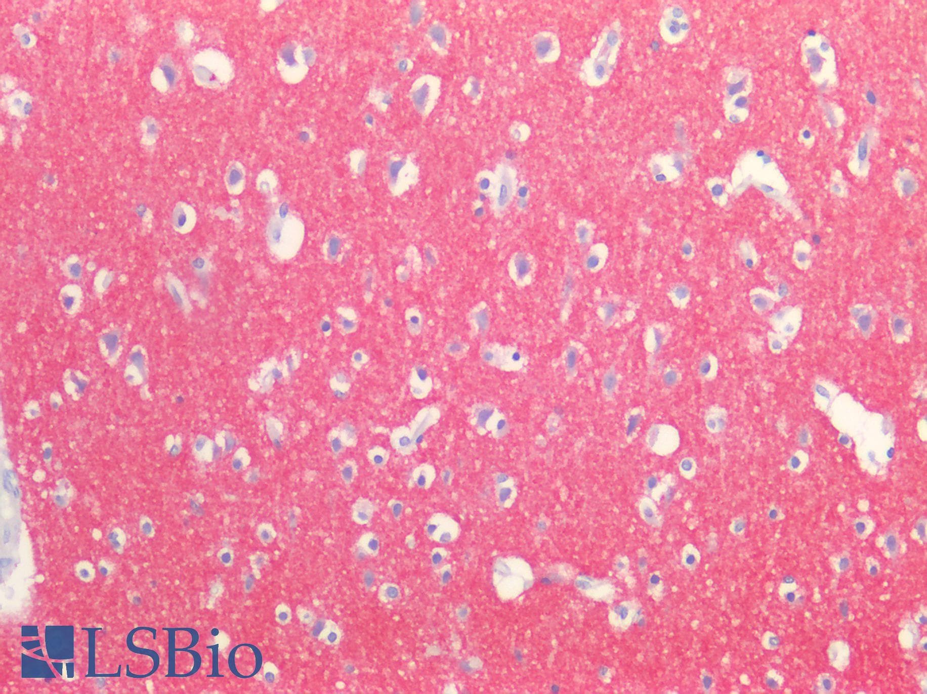 Polyclonal Rabbit anti-Human SYT1 / Synaptotagmin Antibody (aa136-422, IHC, WB)