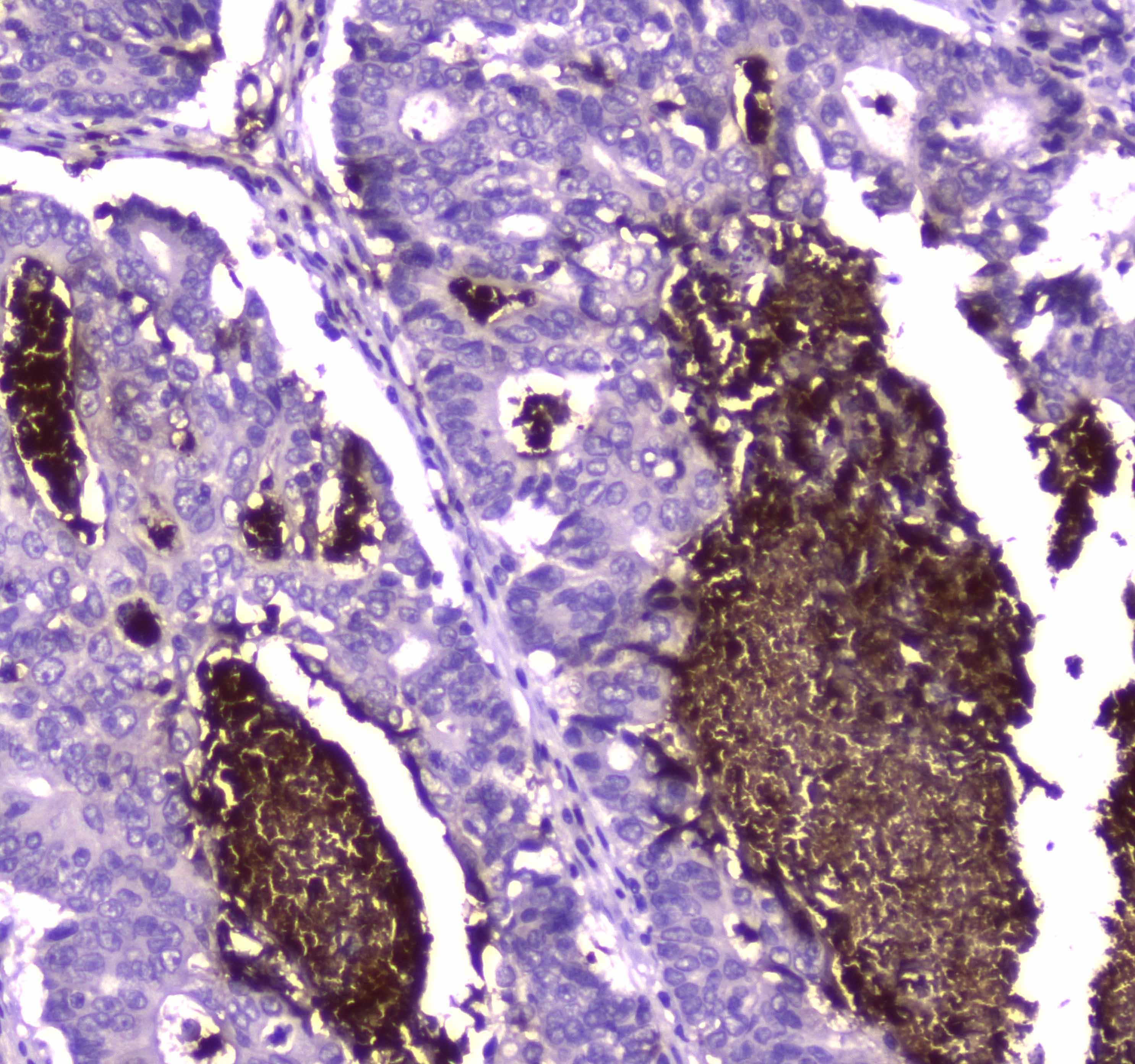 Polyclonal Rabbit anti-Human LF / LTF / Lactoferrin Antibody (IHC, WB)