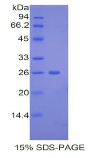 Mouse ADAMTS12 Protein (Recombinant His)