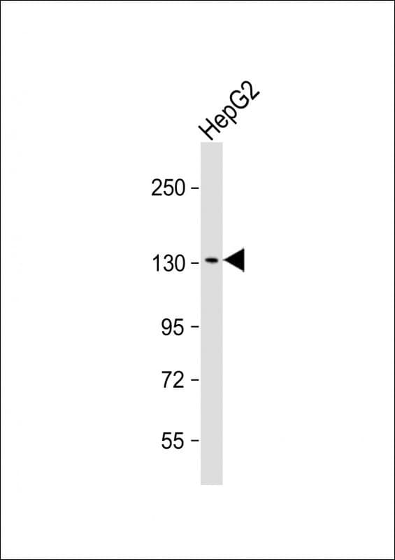 KL / Klotho Antibody (Internal)