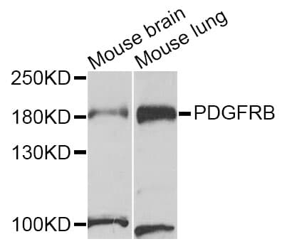 PDGFRB / PDGFR Beta Antibody
