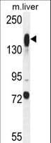 ASXL1 Antibody (aa521-549)