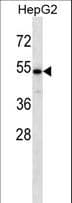 GALNAC4ST-2 / CHST9 Antibody (aa21-50)