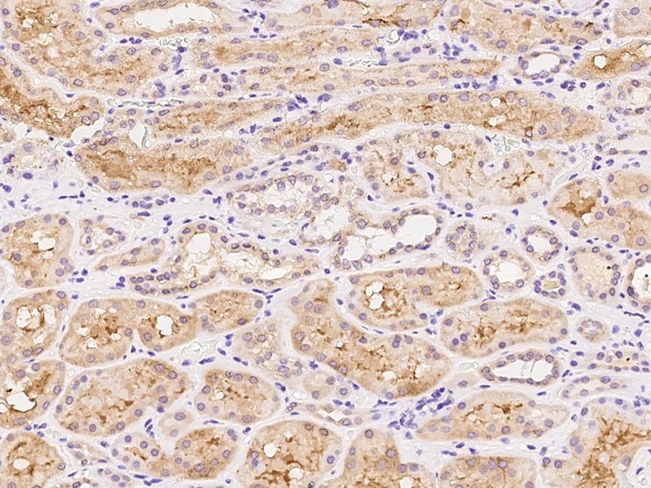 Polyclonal Rabbit anti-Human APLP2 Antibody (IHC)