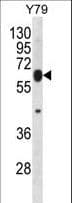 Polyclonal Rabbit anti-Human RNF180 Antibody (aa401-430, IHC, WB)