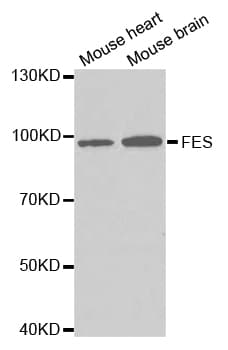 FES Antibody