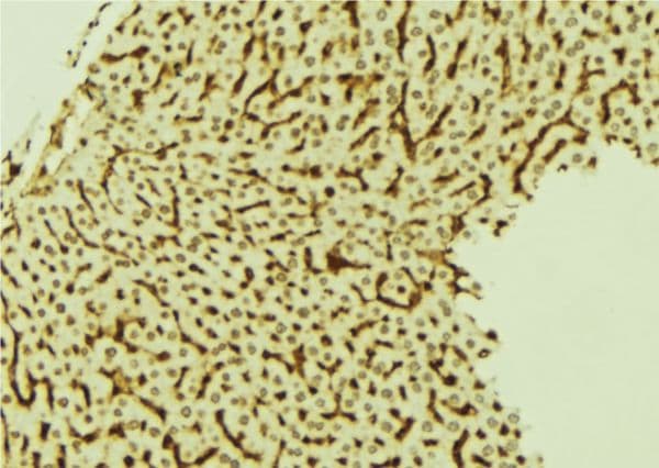 LRP1 / CD91 Antibody