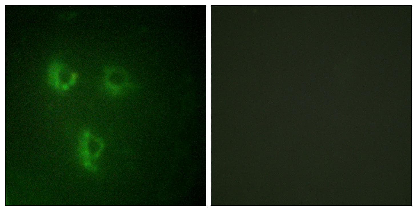 TMEPAI / PMEPA1 Antibody