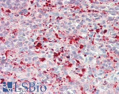 CDKN2C / p18 INK4c Antibody (aa113-139)