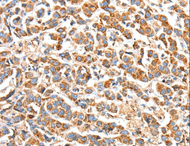BAK1 / BAK Antibody