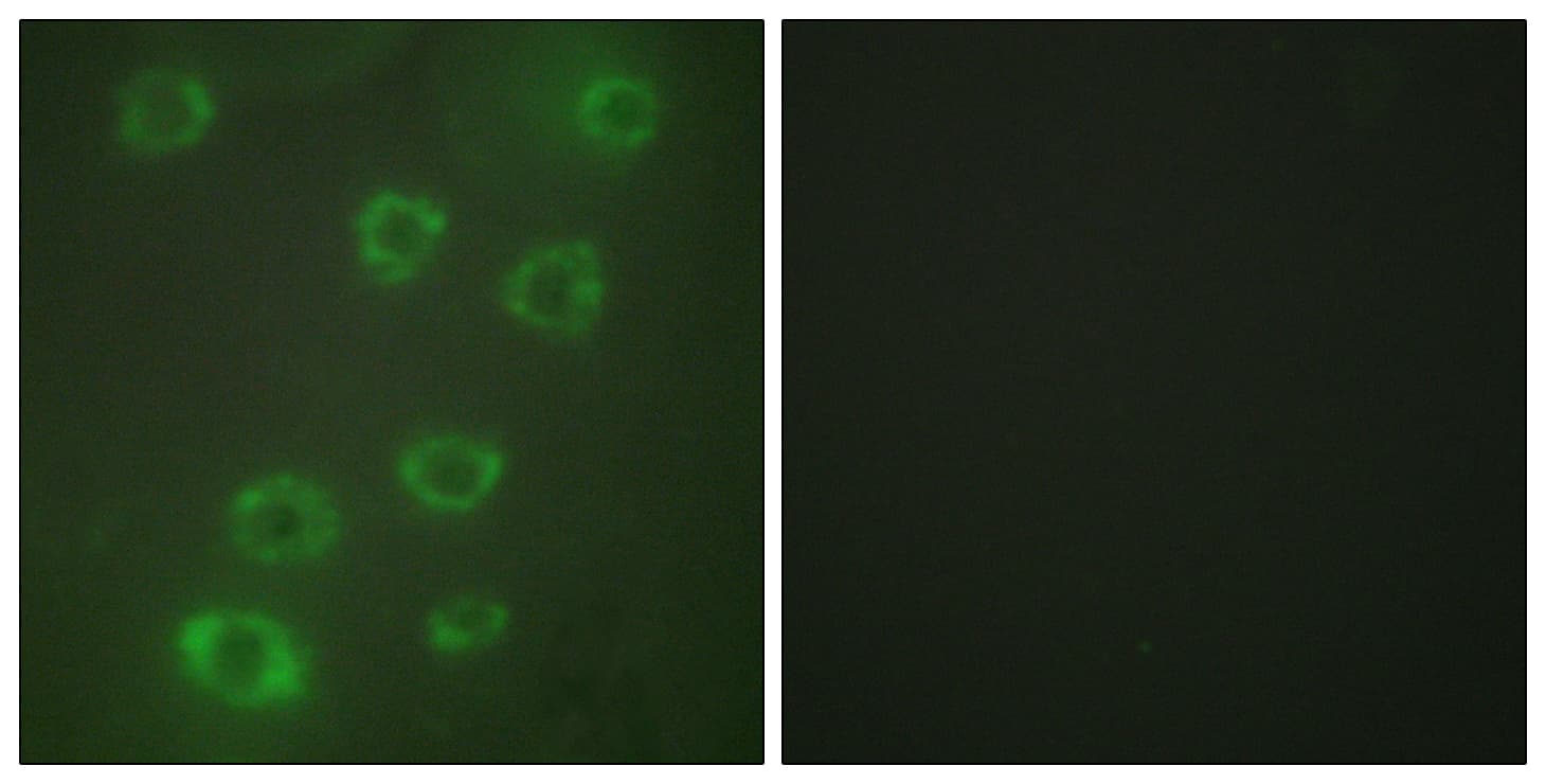 Polyclonal Rabbit anti-Human PTX3 / Pentraxin 3 Antibody (aa1-50, IF, WB)