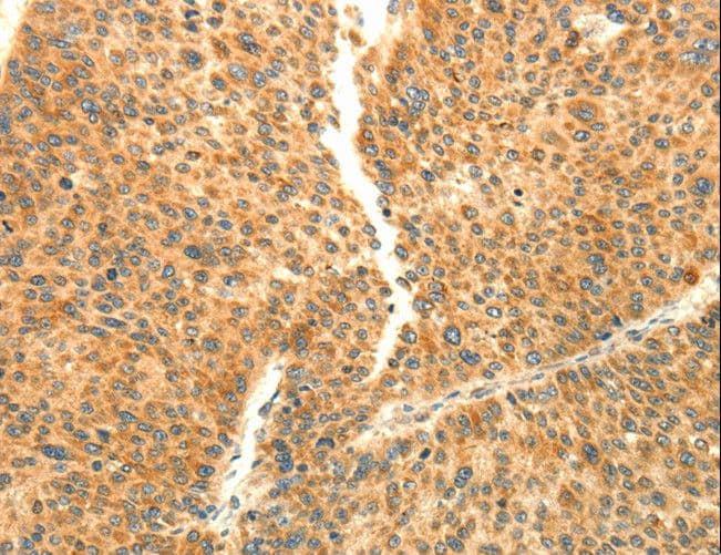AARS2 Antibody