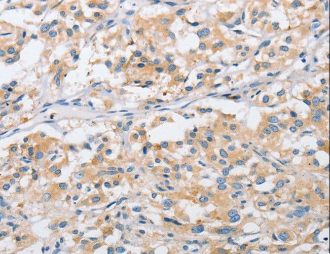 ARHGEF9 / Collybistin Antibody