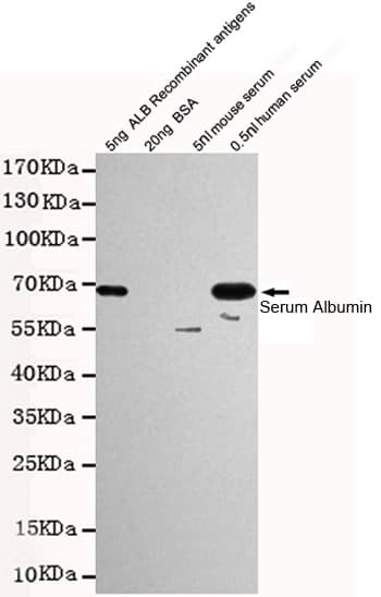 ALB / Serum Albumin Antibody