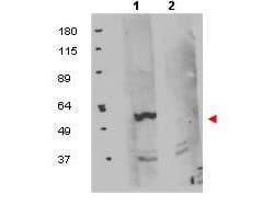 Polyclonal Rabbit anti-Human FKBP38 / FKBP8 Antibody (IHC, WB)