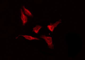 OR8G5 Antibody