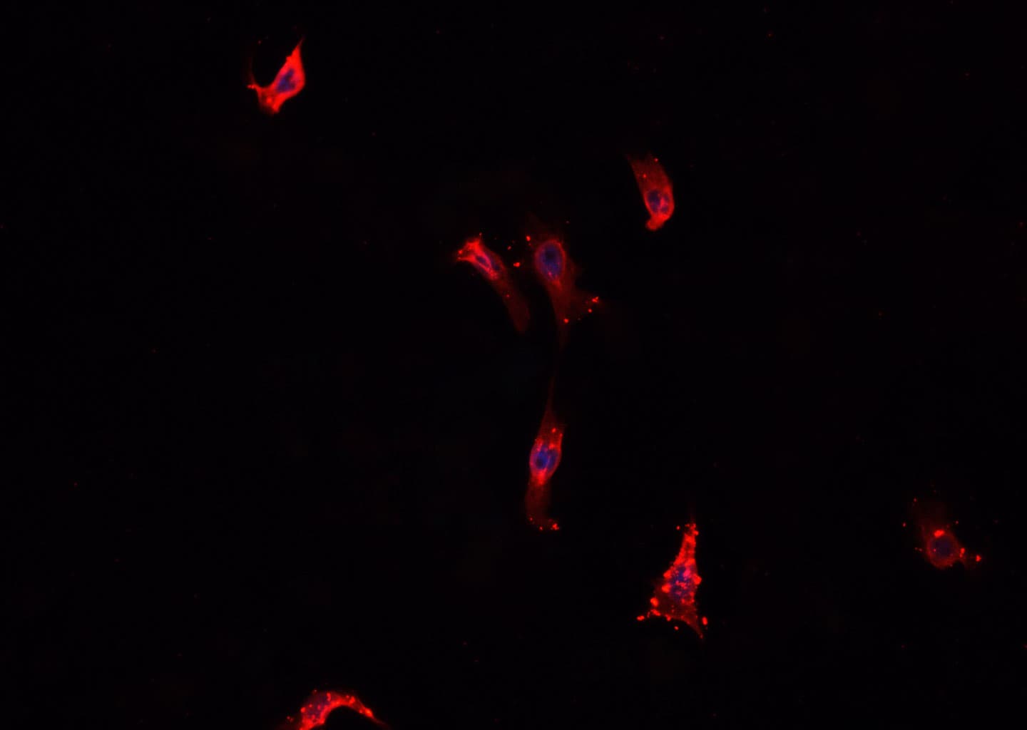 COL1A2 / Collagen I Alpha 2 Antibody