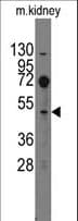 Polyclonal Rabbit anti-Mouse EVX2 Antibody (aa444-475, WB)