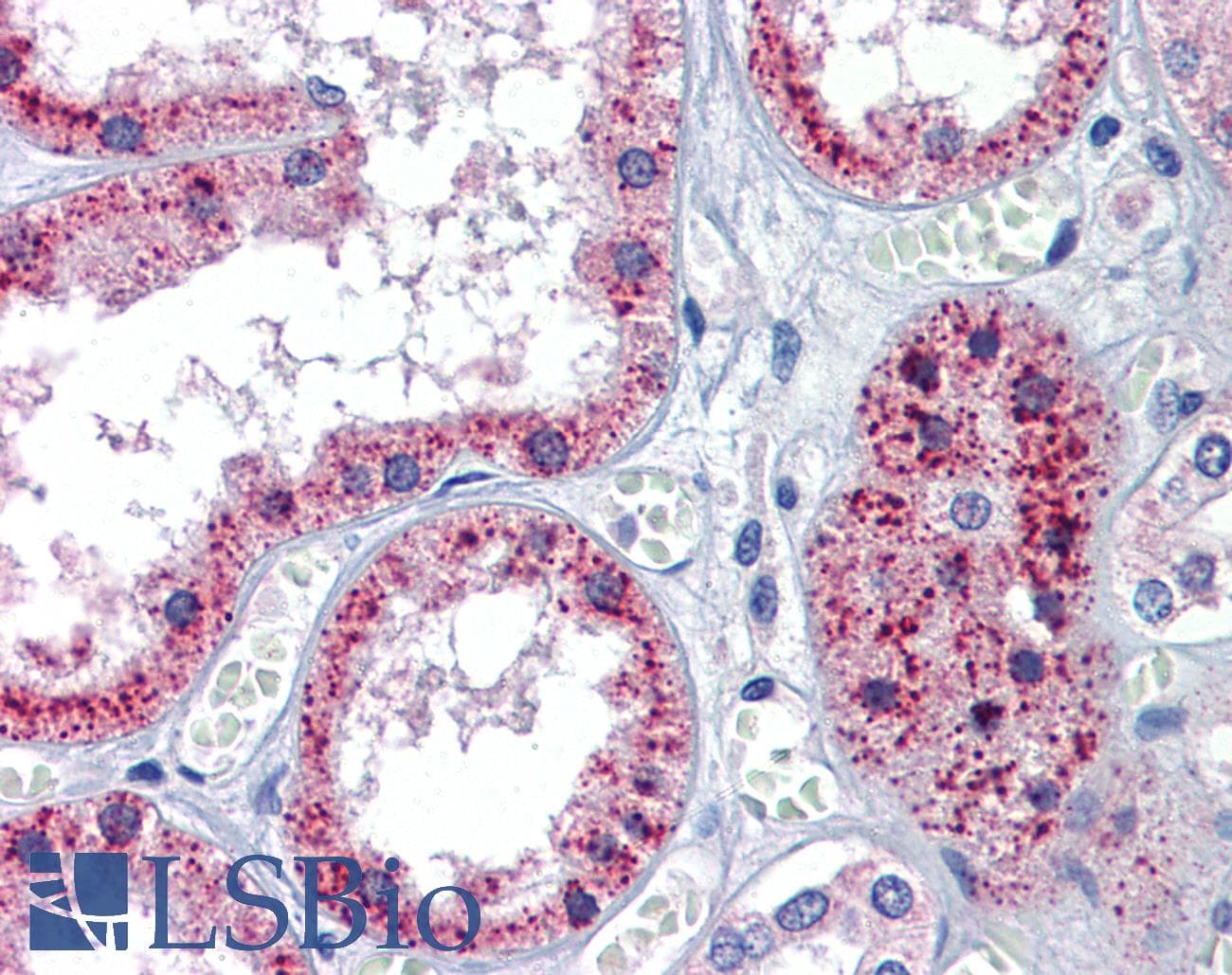 Polyclonal Rabbit anti-Human PTCH1 / Patched 1 Antibody (aa58-107, IHC, WB)