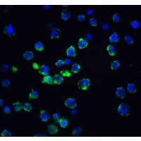 Polyclonal Rabbit anti-Human ACIN1 / Acinus Antibody (IF, WB)
