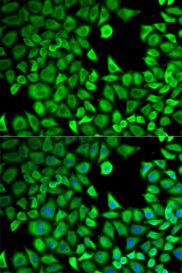 LTA4H / LTA4 Antibody