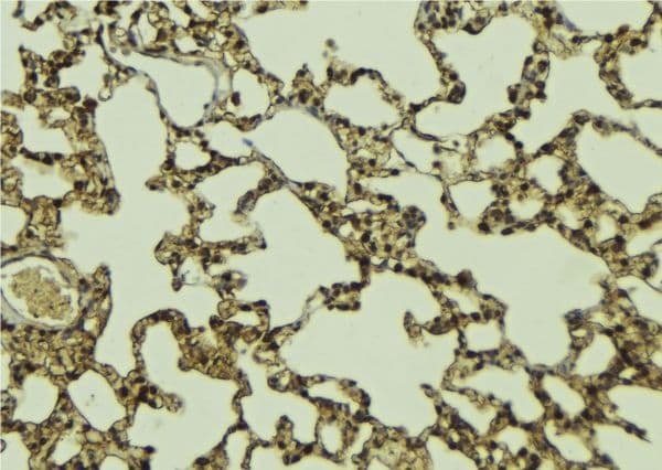 MEN1 / Menin Antibody