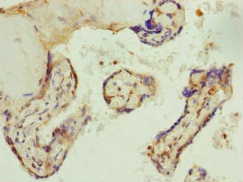Polyclonal Rabbit anti-Human AP1M1 Antibody (IHC, WB)