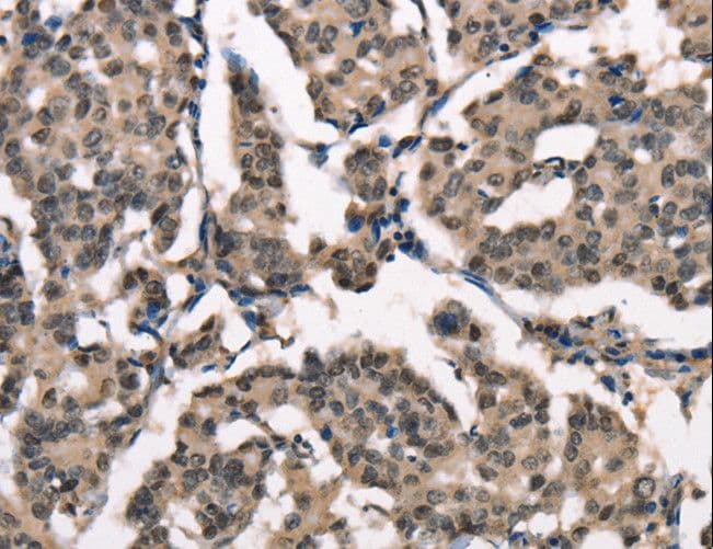 NDNL2 Antibody