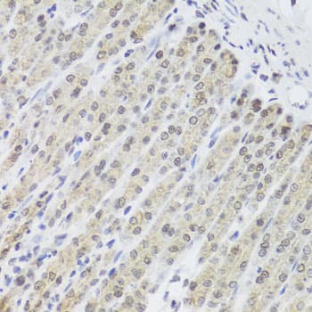 Polyclonal Rabbit anti-Human PHF9 / FANCL Antibody (IHC, WB)