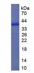 Human HNP-4 / DEFA4 Protein (Recombinant His-GST)