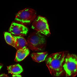Monoclonal Mouse anti-Human SLC2A4 / GLUT-4 Antibody (clone 3G10A3, aa224-353, IHC, IF, WB)