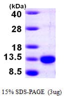 Human PCBD1 / PHS Protein (Recombinant His)