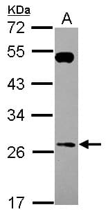 Polyclonal Rabbit anti-Human RAB26 Antibody (WB)