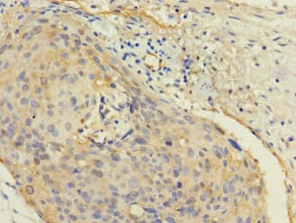 Polyclonal Rabbit anti-Human CALML3 Antibody (IHC)
