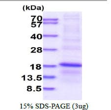 Human RPL34 / Ribosomal Protein L34 (Recombinant His)